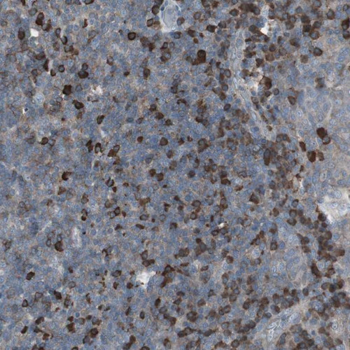 Immunohistochemical staining of human tonsil shows strong cytoplasmic positivity in lymphoid cells outside reaction centra.