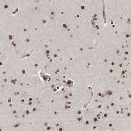 Immunohistochemical staining of human cerebral cortex shows nuclear positivity in both neuronal and glial cells.