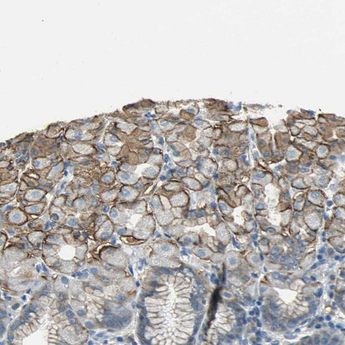 Immunohistochemical staining of human cerebral cortex shows moderate cytoplasmic positivity in neuronal cells.