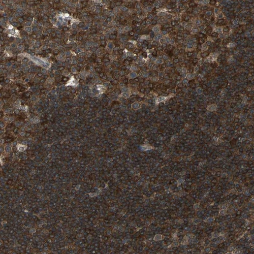 Immunohistochemical staining of human lymph node shows strong cytoplasmic positivity.