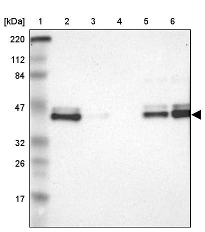 Lane 1: Marker [kDa] 220, 112, 84, 47, 32, 26, 17<br/>Lane 2: Human cell line RT-4<br/>Lane 3: Human cell line U-251MG sp<br/>Lane 4: Human plasma (IgG/HSA depleted)<br/>Lane 5: Human liver tissue<br/>Lane 6: Human tonsil tissue