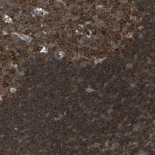 Immunohistochemical staining of human lymph node shows strong cytoplasmic positivity.