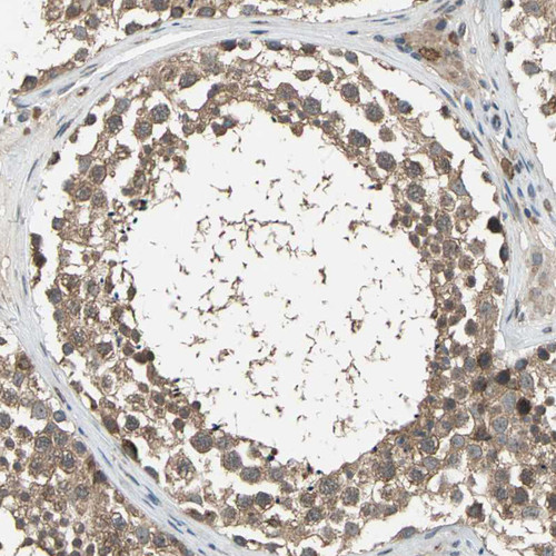 Immunohistochemical staining of human testis shows moderate cytoplasmic positivity in cells in seminiferous ducts.