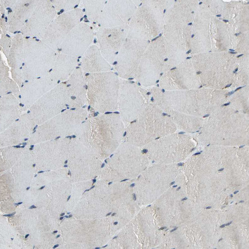 Immunohistochemical staining of human skeletal muscle shows very weak positivity in myocytes as expected.