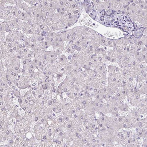 Immunohistochemical staining of human liver shows no positivity in hepatocytes as expected.