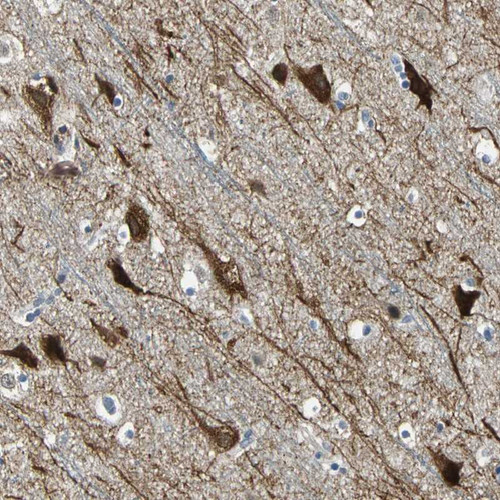 Immunohistochemical staining of human cerebral cortex shows strong cytoplasmic and nuclear positivity in neuronal cells.