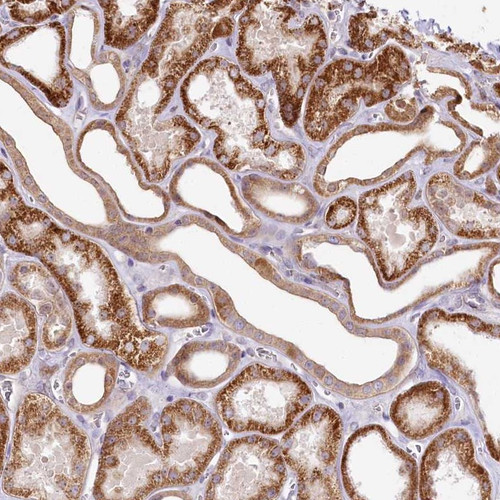 Immunohistochemical staining of human kidney shows strong cytoplasmic positivity in renal tubules.