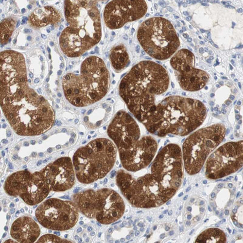 Immunohistochemical staining of human kidney shows strong cytoplasmic and nuclear positivity in cells in tubules.