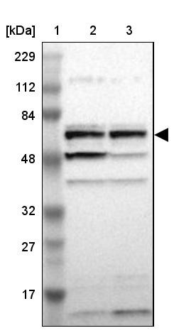 Lane 1: Marker [kDa] 229, 112, 84, 48, 32, 27, 17<br/>Lane 2: Human cell line RT-4<br/>Lane 3: Human cell line U-251MG sp