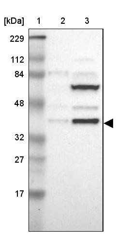 Lane 1: Marker [kDa] 229, 112, 84, 48, 32, 27, 17<br/>Lane 2: Human cell line RT-4<br/>Lane 3: Human cell line U-251MG sp