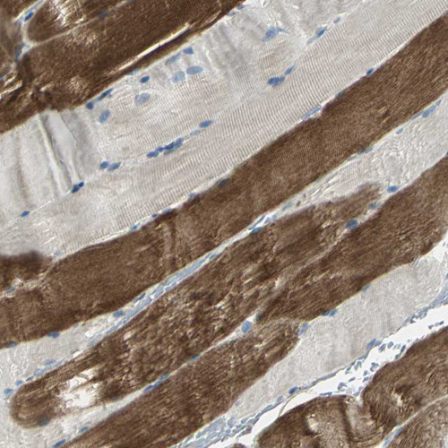 Immunohistochemical staining of human skeletal muscle shows  strong cytoplasmic positivity in myocytes.