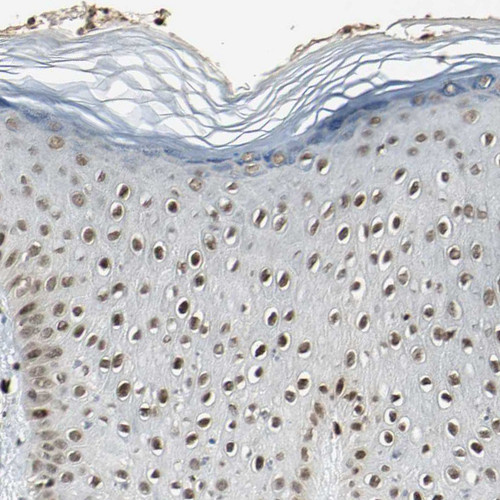 Immunohistochemical staining of human skin shows moderate nuclear positivity in squamous epithelial cells.