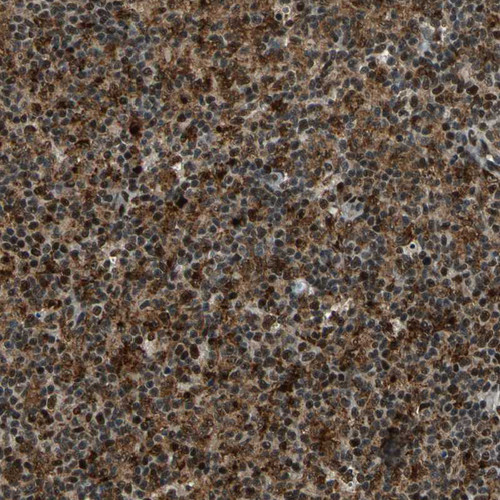Immunohistochemical staining of human spleen shows moderate nuclear positivity in cells in red and white pulp.