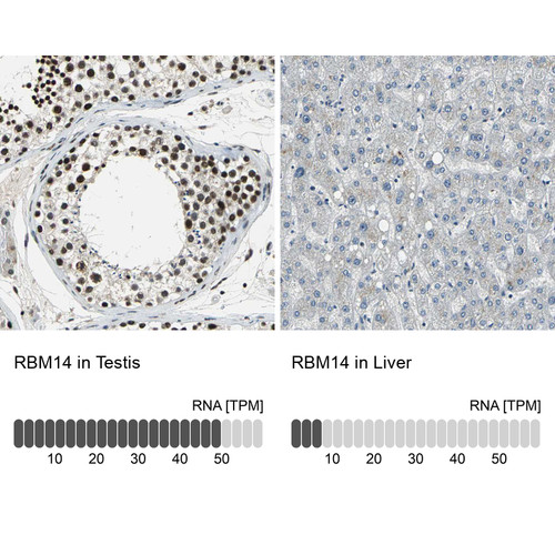 Immunohistochemistry analysis in human testis and liver tissues using HPA006628 antibody. Corresponding RBM14 RNA-seq data are presented for the same tissues.