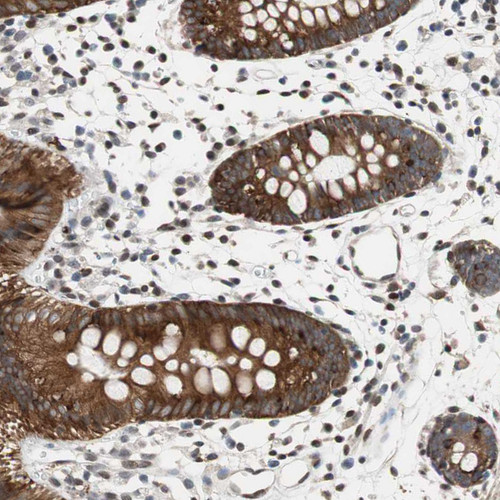 Immunohistochemical staining of human urinary bladder shows strong cytoplasmic positivity in urothelial cells.