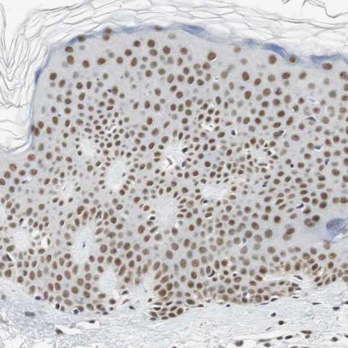 Immunohistochemical staining of human skin shows strong nuclear positivity in epidermal cells.