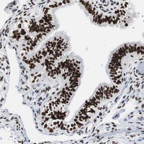 Immunohistochemical staining of human fallopian tube shows strong nuclear positivity in glandular cells.