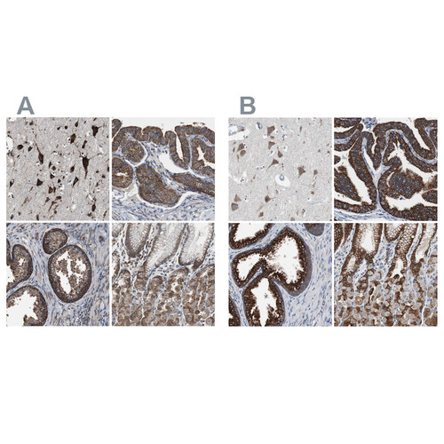 Immunohistochemical staining of human cerebral cortex, fallopian tube, prostate and stomach using Anti-USP10 antibody HPA006731 (A) shows similar protein distribution across tissues to independent antibody HPA006749 (B).