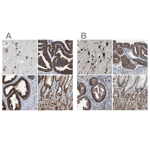 Immunohistochemical staining of human cerebral cortex, fallopian tube, prostate and stomach using Anti-USP10 antibody HPA006749 (A) shows similar protein distribution across tissues to independent antibody HPA006731 (B).