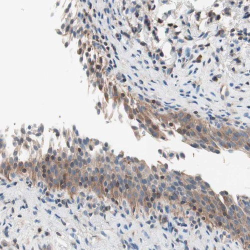 Immunohistochemical staining of human urinary bladder shows weak  nuclear positivity in subset of urothelial cells.