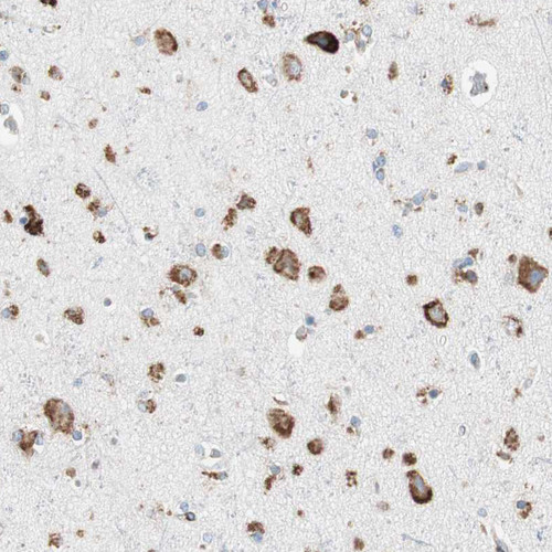 Immunohistochemical staining of human cerebral cortex shows strong cytoplasmic positivity in neuronal and glial cells.