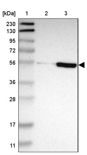 Lane 1: Marker [kDa] 230, 130, 95, 72, 56, 36, 28, 17, 11<br/>Lane 2: Human cell line RT-4<br/>Lane 3: Human cell line U-251MG sp