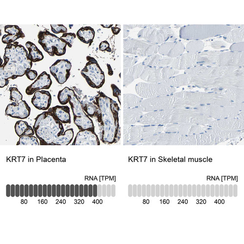 Immunohistochemistry analysis in human placenta and skeletal muscle tissues using HPA007272 antibody. Corresponding KRT7 RNA-seq data are presented for the same tissues.