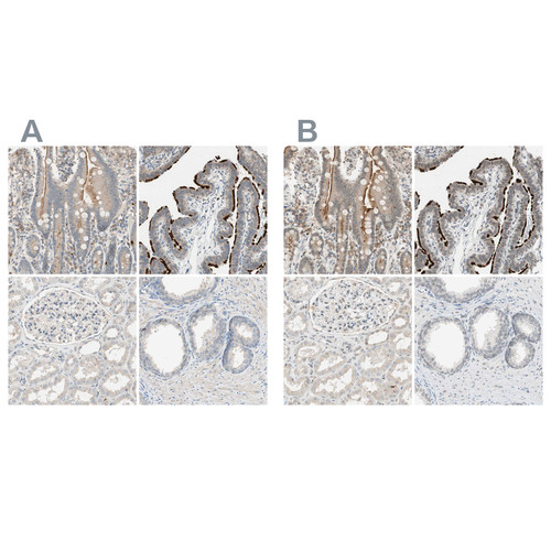 Immunohistochemical staining of human duodenum, fallopian tube, kidney and prostate using Anti-MS4A8 antibody HPA007318 (A) shows similar protein distribution across tissues to independent antibody HPA007319 (B). Immunohistochemical staining of human duodenum, fallopian tube, kidney and prostate using Anti-MS4A8 antibody HPA007318 (A) shows similar protein distribution across tissues to independent antibody HPA007319 (B).