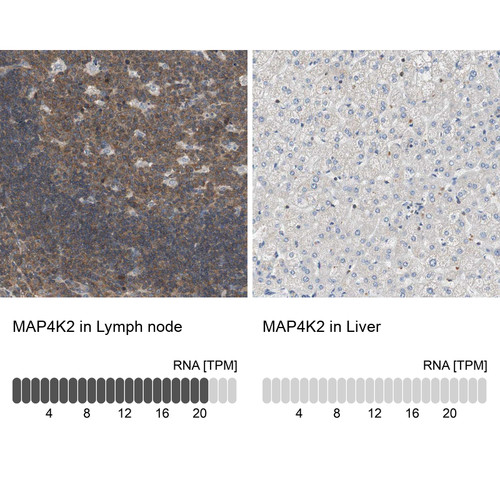 Immunohistochemistry analysis in human lymph node and liver tissues using Anti-MAP4K2 antibody. Corresponding MAP4K2 RNA-seq data are presented for the same tissues.
