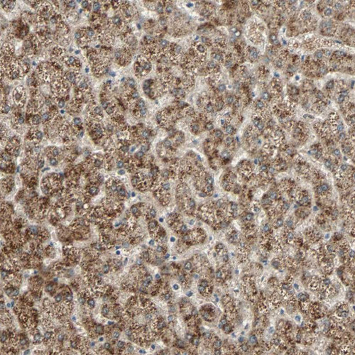 Immunohistochemical staining of human liver shows cytoplasmic positivity in hepatocytes.