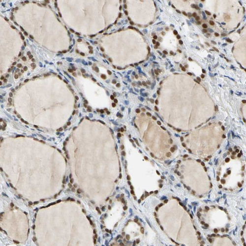 Immunohistochemical staining of human thyroid gland shows nuclear positivity in glandular cells.