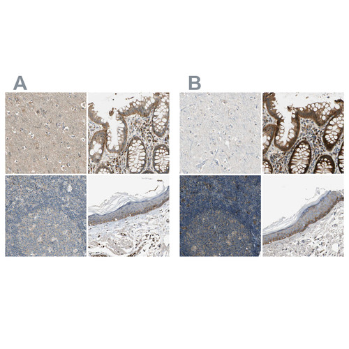 Immunohistochemical staining of human cerebral cortex, gastrointestinal, lymph node and skin using Anti-MST1R antibody HPA007657 (A) shows similar protein distribution across tissues to independent antibody HPA008180 (B).