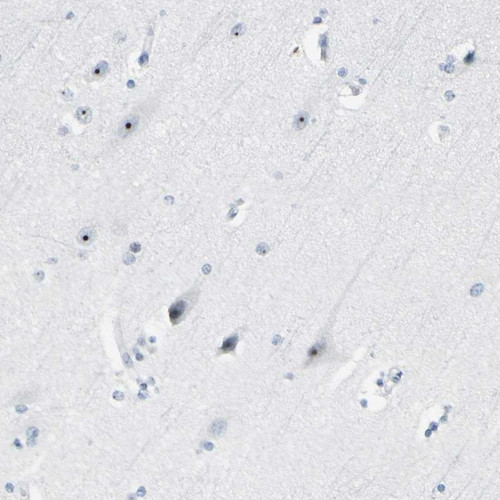 Immunohistochemical staining of human cerebral cortex shows strong nuclear positivity in neuronal cells.