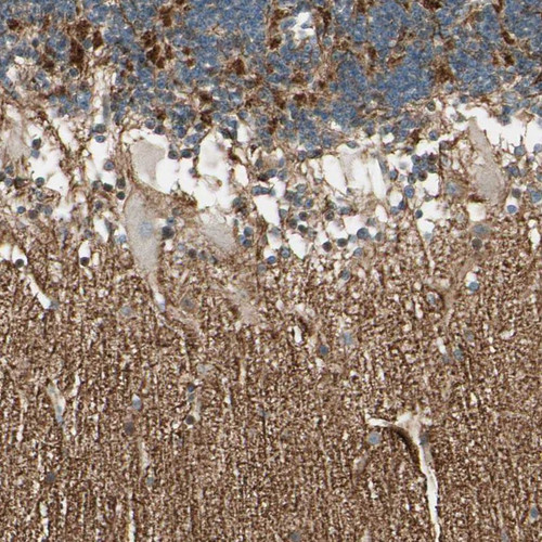 Immunohistochemical staining of human cerebellum shows weak cytoplasmic positivity in Purkinje cells.