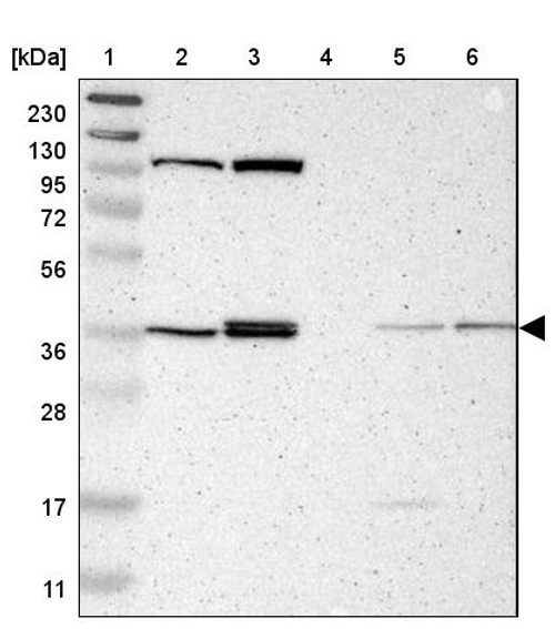 Lane 1: Marker [kDa] 230, 130, 95, 72, 56, 36, 28, 17, 11<br/>Lane 2: Human cell line RT-4<br/>Lane 3: Human cell line U-251MG sp<br/>Lane 4: Human plasma (IgG/HSA depleted)<br/>Lane 5: Human liver tissue<br/>Lane 6: Human tonsil tissue