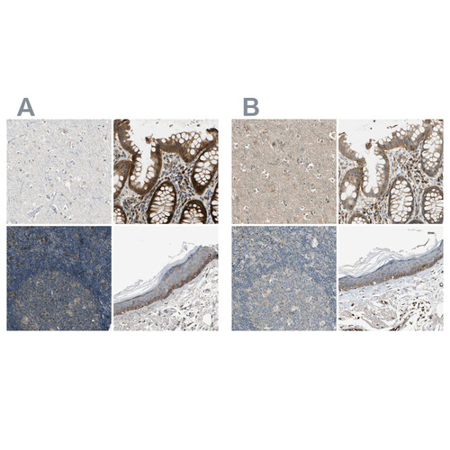 Immunohistochemical staining of human cerebral cortex, gastrointestinal, lymph node and skin using Anti-MST1R antibody HPA008180 (A) shows similar protein distribution across tissues to independent antibody HPA007657 (B).