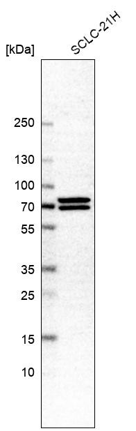 Western blot analysis in human cell line SCLC-21H.