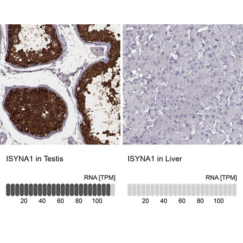 Immunohistochemistry analysis in human testis and liver tissues using Anti-ISYNA1 antibody. Corresponding ISYNA1 RNA-seq data are presented for the same tissues.
