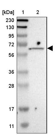 Lane 1: Marker [kDa] 230, 130, 95, 72, 56, 36, 28, 17, 11<br/>Lane 2: Human cell line RT-4
