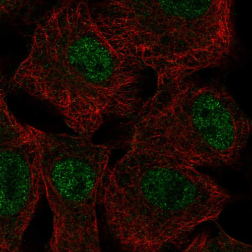 Immunofluorescent staining of human cell line A549 shows localization to nucleoplasm.