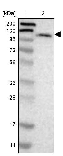 Lane 1: Marker [kDa] 230, 130, 95, 72, 56, 36, 28, 17, 11<br/>Lane 2: Human cell line RT-4