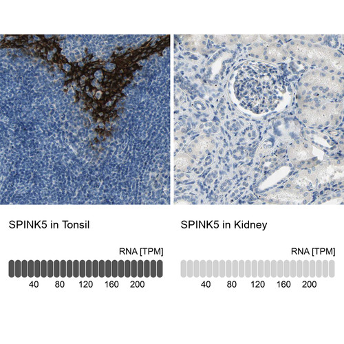 Immunohistochemistry analysis in human tonsil and kidney tissues using HPA009067 antibody. Corresponding SPINK5 RNA-seq data are presented for the same tissues.