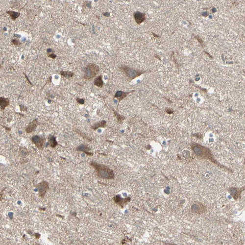 Immunohistochemical staining of human cerebral cortex shows moderate to strong cytoplasmic positivity in neurons.