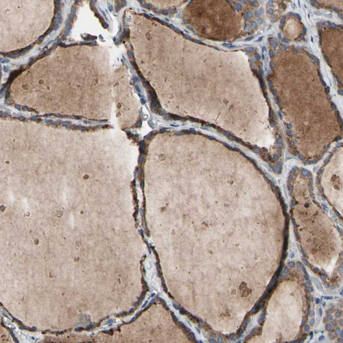 Immunohistochemical staining of human thyroid gland shows strong cytoplasmic positivity in glandular cells.