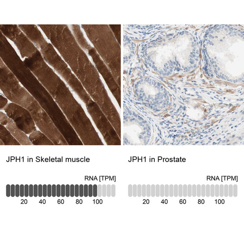 Immunohistochemistry analysis in human skeletal muscle and prostate tissues using Anti-JPH1 antibody. Corresponding JPH1 RNA-seq data are presented for the same tissues.