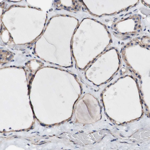 Immunohistochemical staining of human thyroid gland shows moderate cytoplasmic positivity in glandular cells.