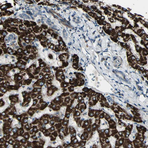 Immunohistochemical staining of human liver shows strong granular cytoplasmic positivity in hepatocytes.