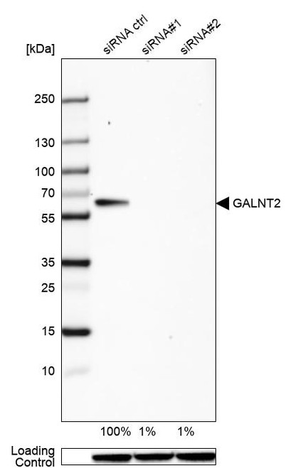 Western blot analysis in HeLa cells transfected with control siRNA, target specific siRNA probe #1 and #2, using Anti-GALNT2 antibody. Remaining relative intensity is presented. Loading control: Anti-GAPDH.