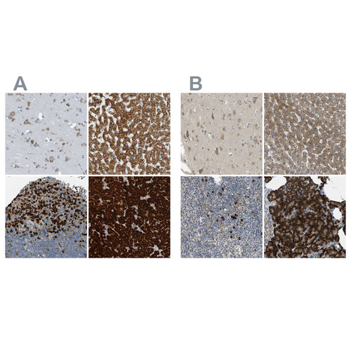 Immunohistochemical staining of human cerebral cortex, liver, lymph node and pancreas using Anti-SSR1 antibody HPA011276 (A) shows similar protein distribution across tissues to independent antibody HPA017062 (B).