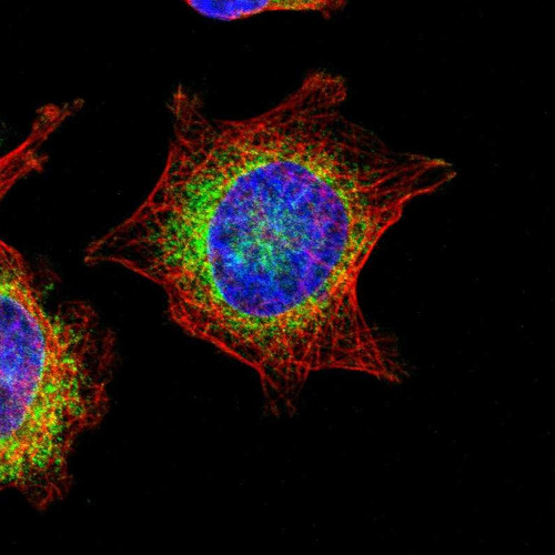 Immunofluorescent staining of human cell line U-251 MG shows localization to endoplasmic reticulum.